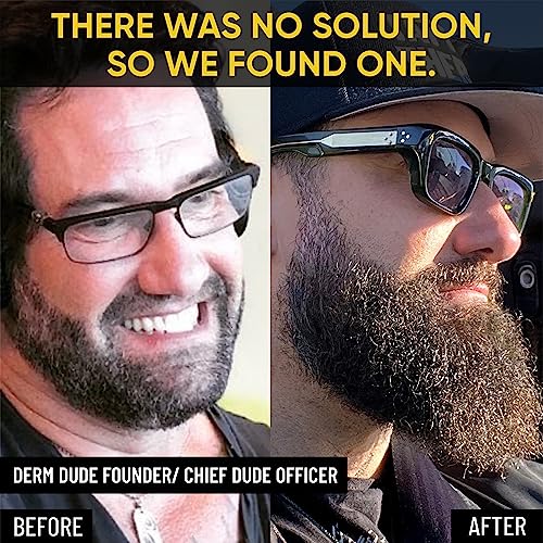 Beard Growth Oil with Jojoba, Peppermint & Castor Oil for Men, 2 Pack A892