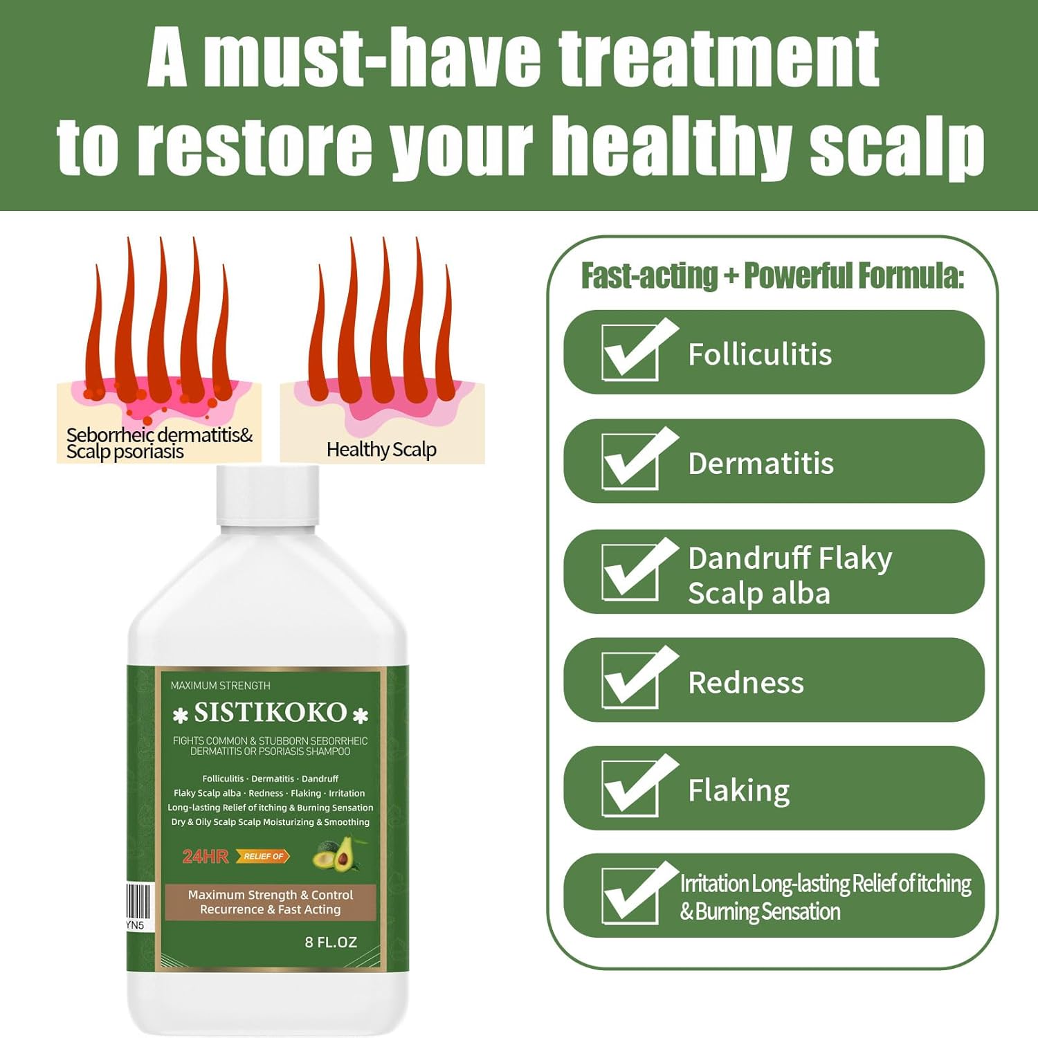 Folliculitis and Dandruff Shampoo for Itchy Scalp I698016