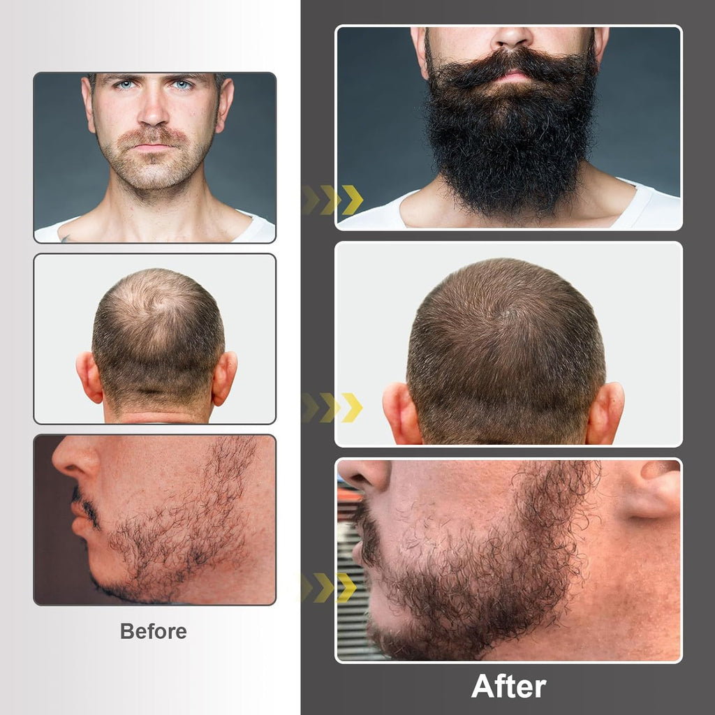 Beard Growth Kit with Oil, Balm and Comb for Men T7175