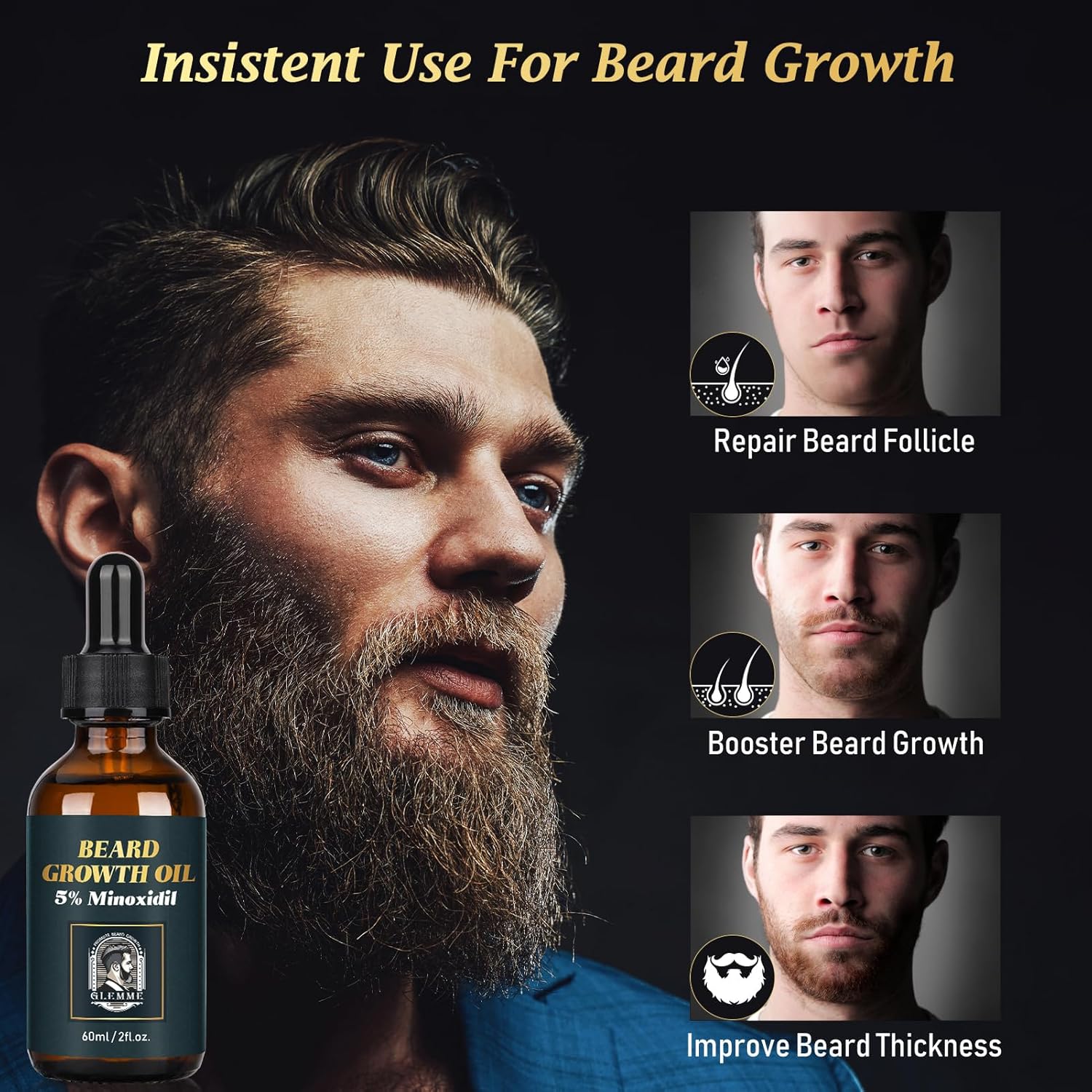 5% Minoxidil Beard Growth Oil & Balm Kit for Patchy Beard K40377