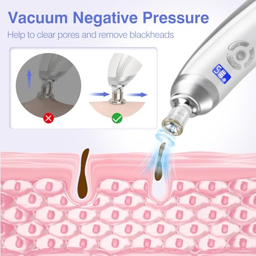 Microdermabrasion Machine Handheld Facial Tool for Home Use I747131