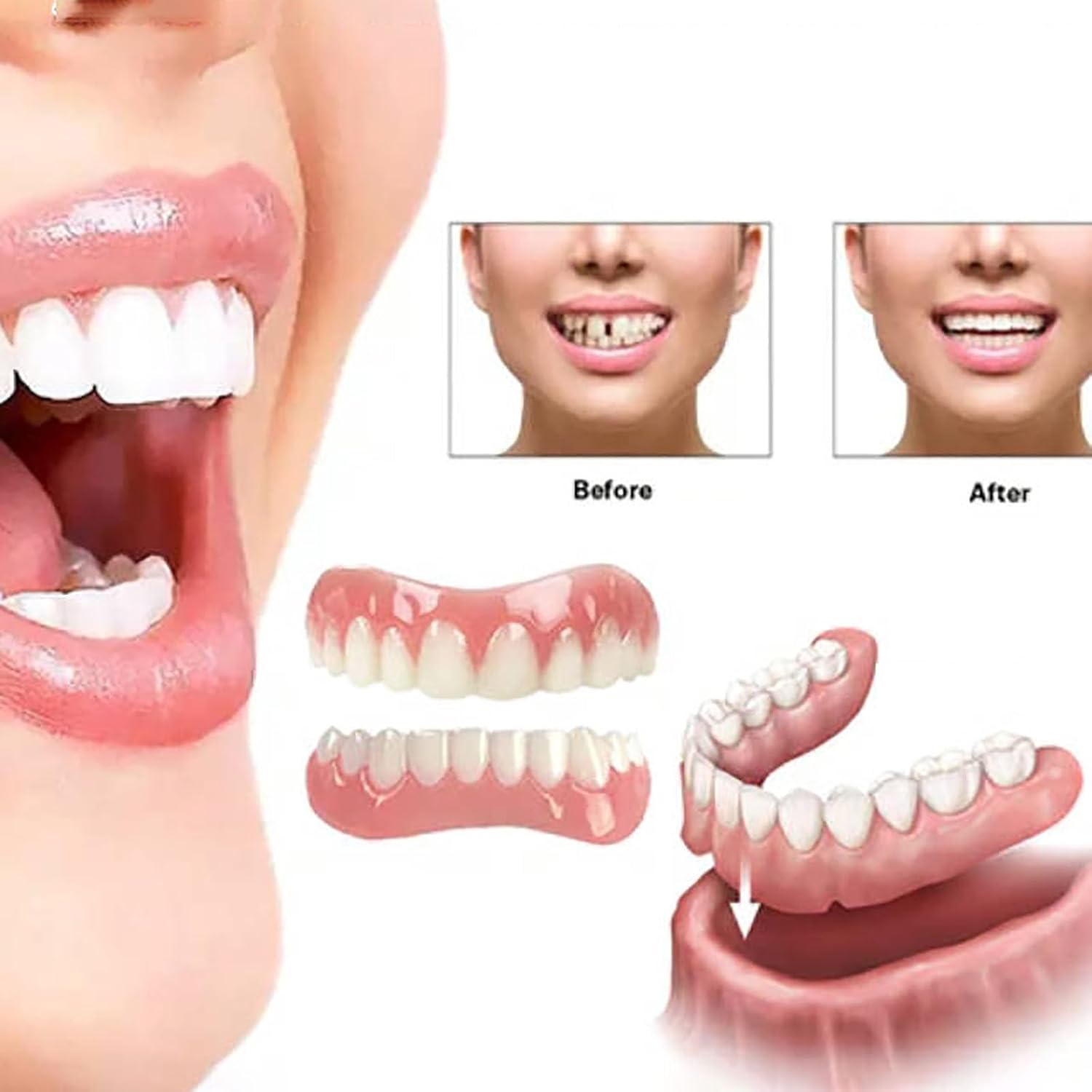 Denture Reline Kit for Upper and Lower Teeth E763