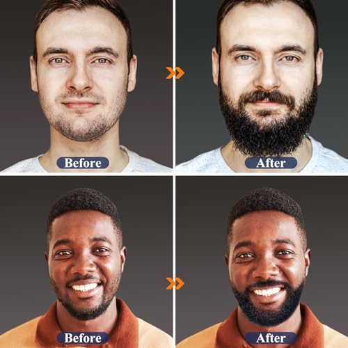 Beard Growth Kit with Oil, Balm & Comb for Patchy Beard I392